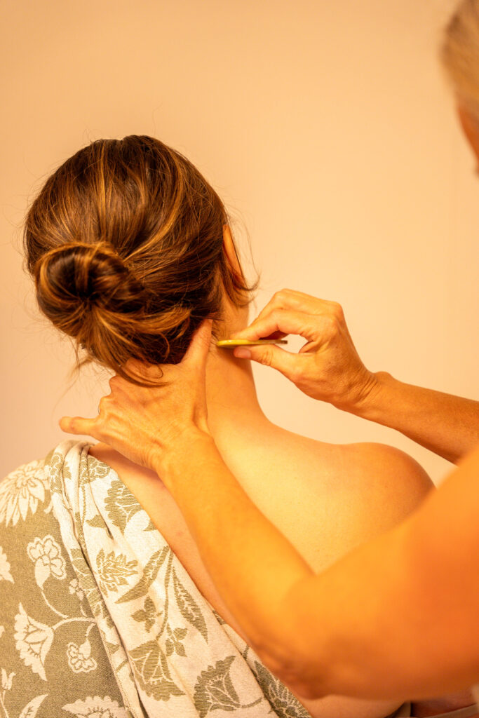 Acupunctuur Waarland